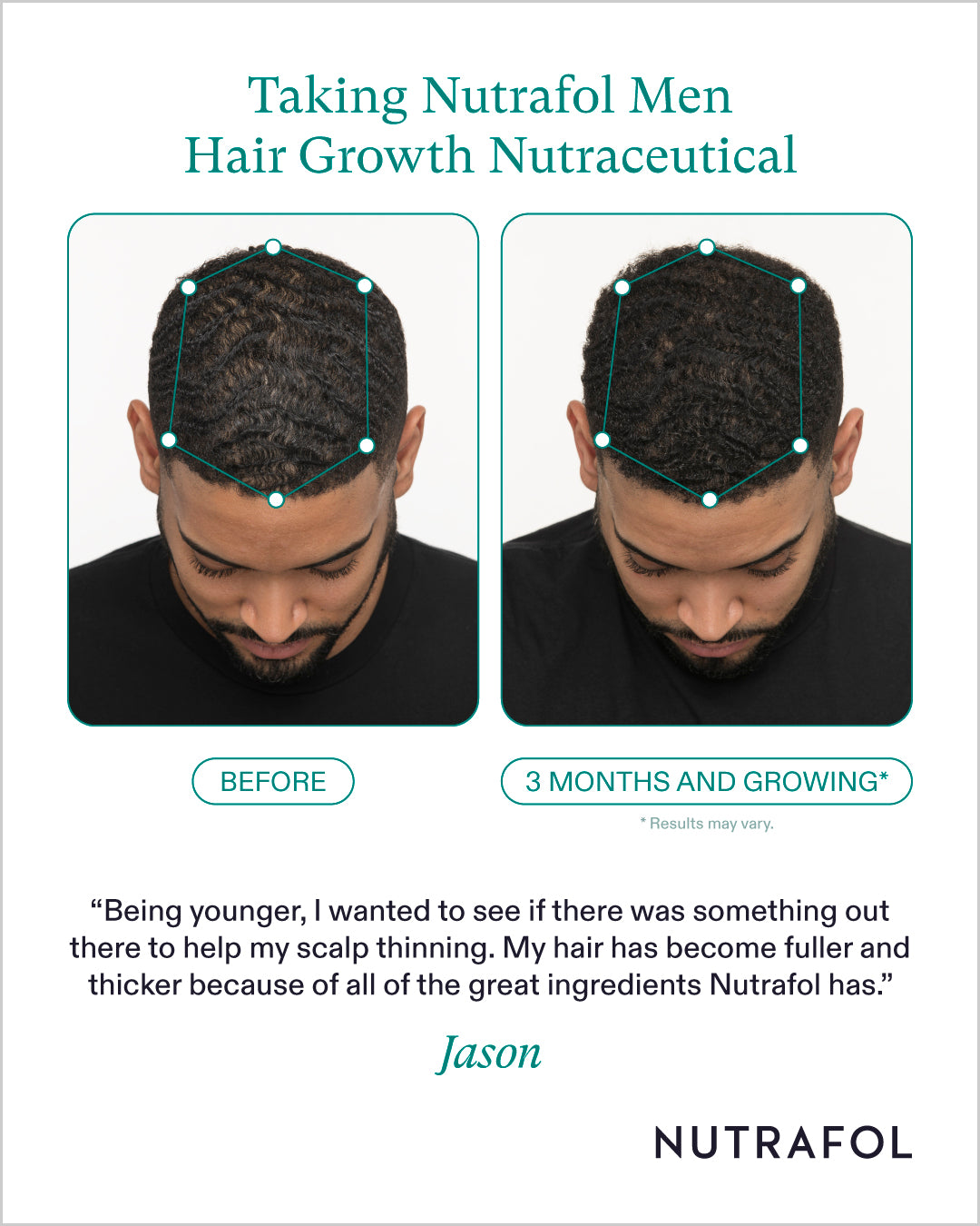 Nutrafol Hair Growth 100% Drug-Free Supplements for Men: 3-Month Supply | Exclusive Provider Pricing at VanityMD