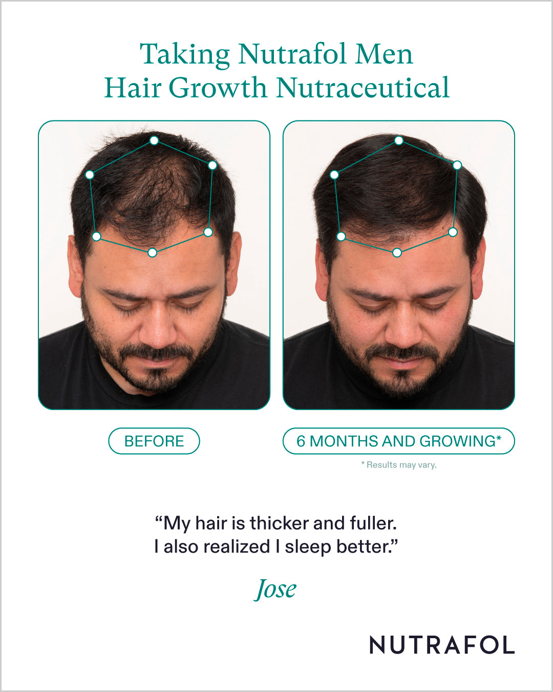 Nutrafol Hair Growth 100% Drug-Free Supplements for Men: 3-Month Supply | Exclusive Provider Pricing at VanityMD