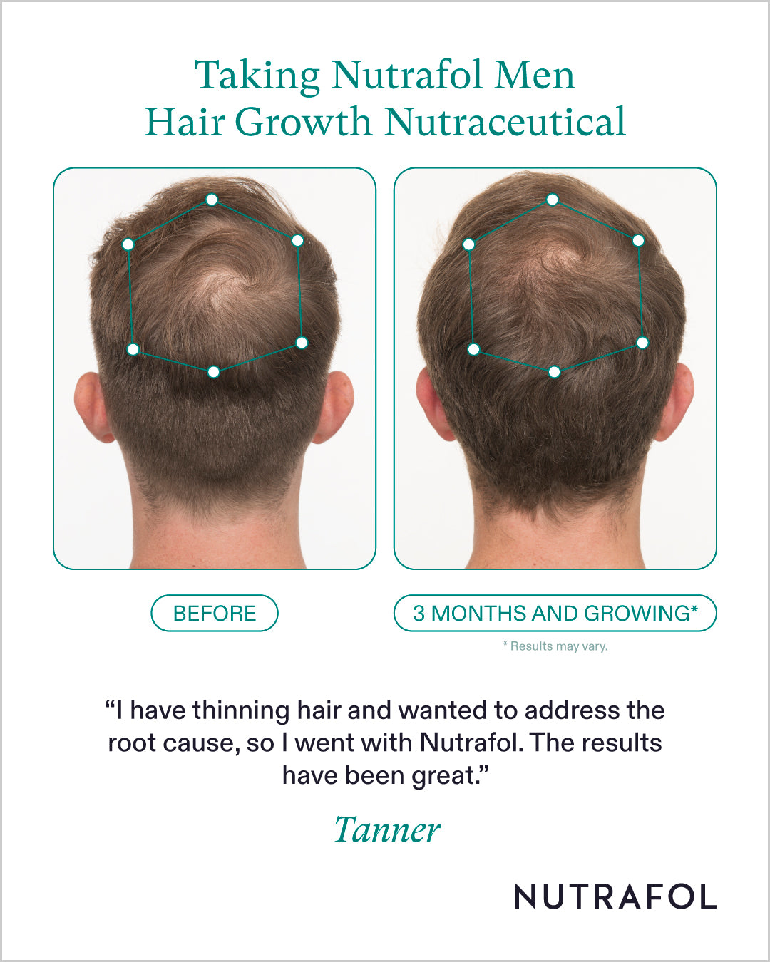 Nutrafol Hair Growth 100% Drug-Free Supplements for Men: 3-Month Supply | Exclusive Provider Pricing at VanityMD